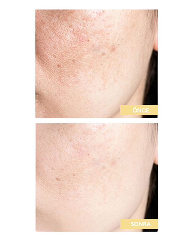 Vitamin C Bright Serum | mClub